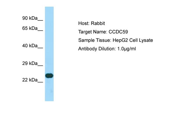 CCDC59 Antibody (aa132-181)