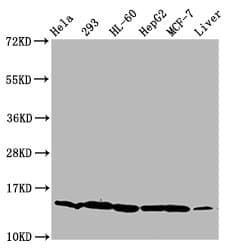 HIST1H2BN Antibody