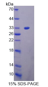Bovine ACAN / Aggrecan Protein (Recombinant His-T7)