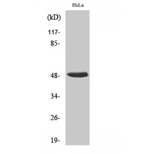HNRNPH1 / hnRNP H Antibody (130-210 aa, Internal)
