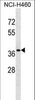 CUTC Antibody (aa67-94)