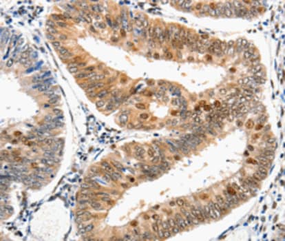 Polyclonal Rabbit anti-Human DDB1 Antibody (IHC, WB)