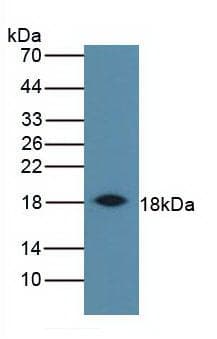 IFN Gamma / Interferon Gamma Antibody