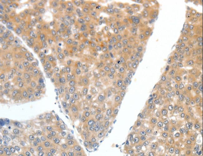 Polyclonal Rabbit anti-Human FSH Receptor / FSHR Antibody (IHC)