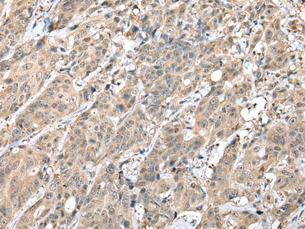 HIF1A / HIF1 Alpha Antibody