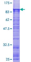 Human ZNF449 Protein (Recombinant GST)