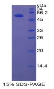 Rat HGFAC / HGFA Protein (Recombinant His-GST)