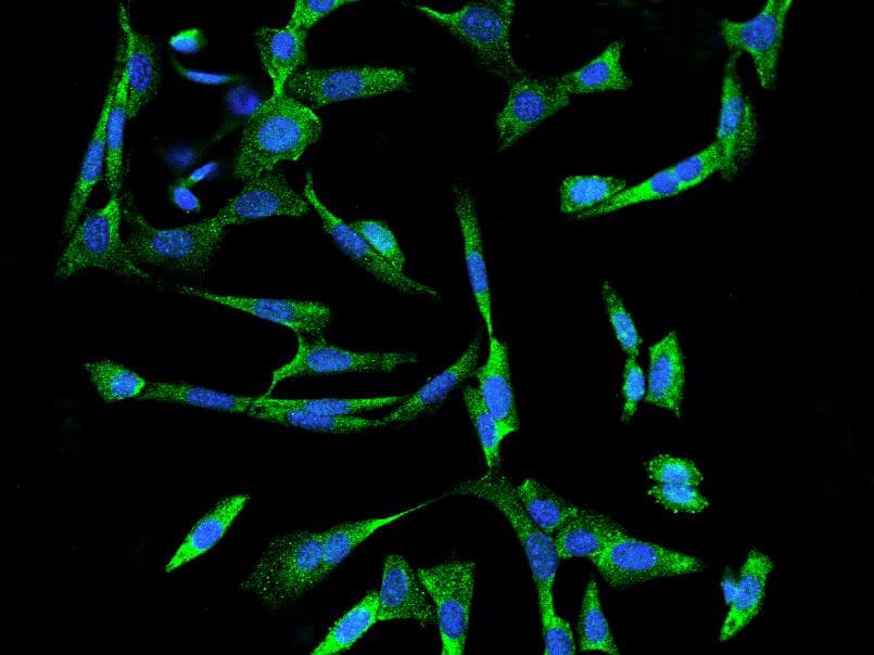 RPS6 / Ribosomal Protein S6 Antibody
