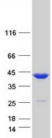 Human TMOD3 / Tropomodulin 3 Protein (Recombinant Myc-DDK (Flag))