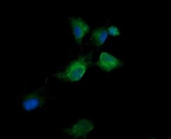 Monoclonal Mouse anti-Human KLK8 / Kallikrein 8 Antibody (clone OTI14E11, IHC, IF, WB)