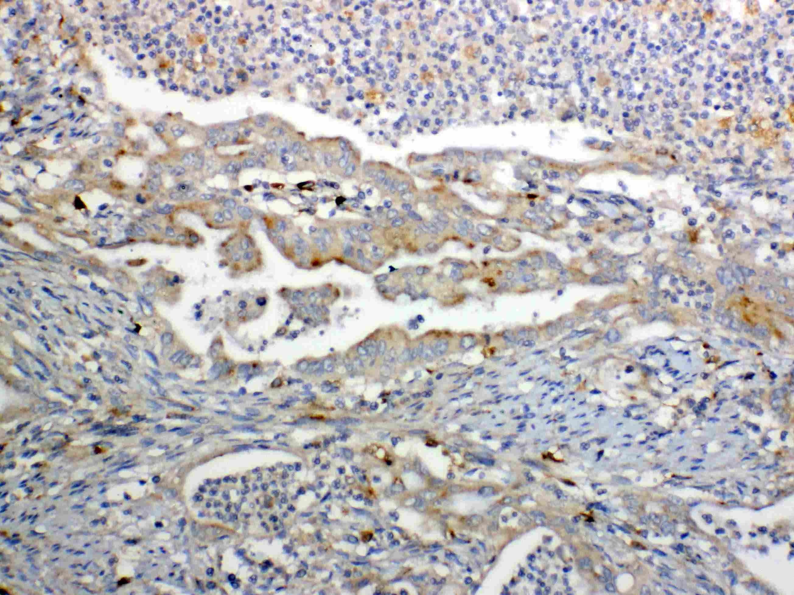 GALNS / Chondroitinase Antibody