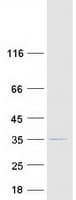 Human MRPS34 Protein (Recombinant Myc-DDK (Flag))