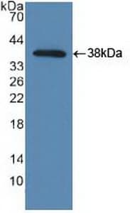 NAK / TBK1 Antibody (aa9-310)