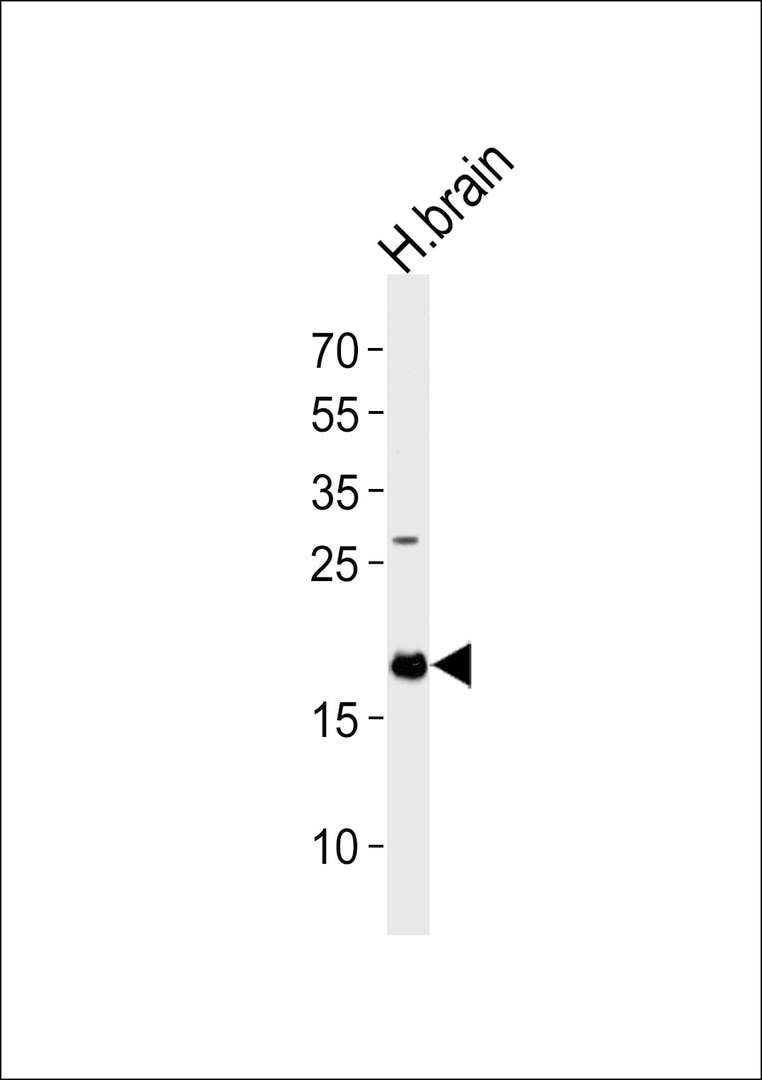 IHC-plus™ 4E-BP2 / EIF4EBP2 Antibody (aa87-115)
