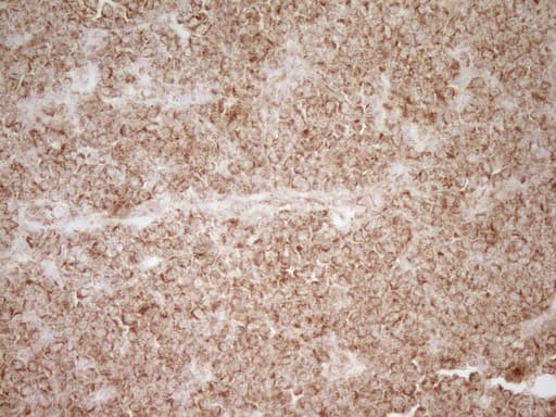 CD40 Antibody (aa21-166, clone OTI8B8)