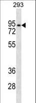 Polyclonal Rabbit anti-Human ANKRD6 / Diversin Antibody (aa314-343, IHC, WB)