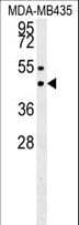 SUV39H1 Antibody