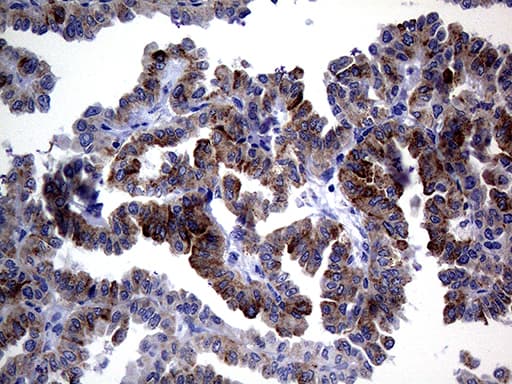 ACVR2 / ACVR2A Antibody (aa214-513, clone OTI1F2)