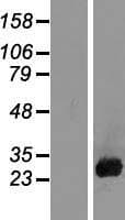 CSH1 / Placental Lactogen Protein (Over-Expression Lysate Myc-DDK (Flag))