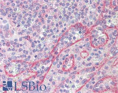 IHC-plus™ SEMA4C / Semaphorin 4C Antibody (aa749-833)