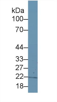ITPA Antibody (aa3-180, PE)