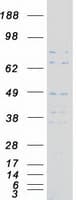 Human ANGEL1 Protein (Recombinant Myc-DDK (Flag))