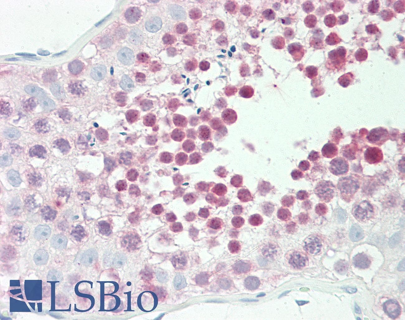 IHC-plus™ GLRX3 / Glutaredoxin 3 Antibody (aa81-110)