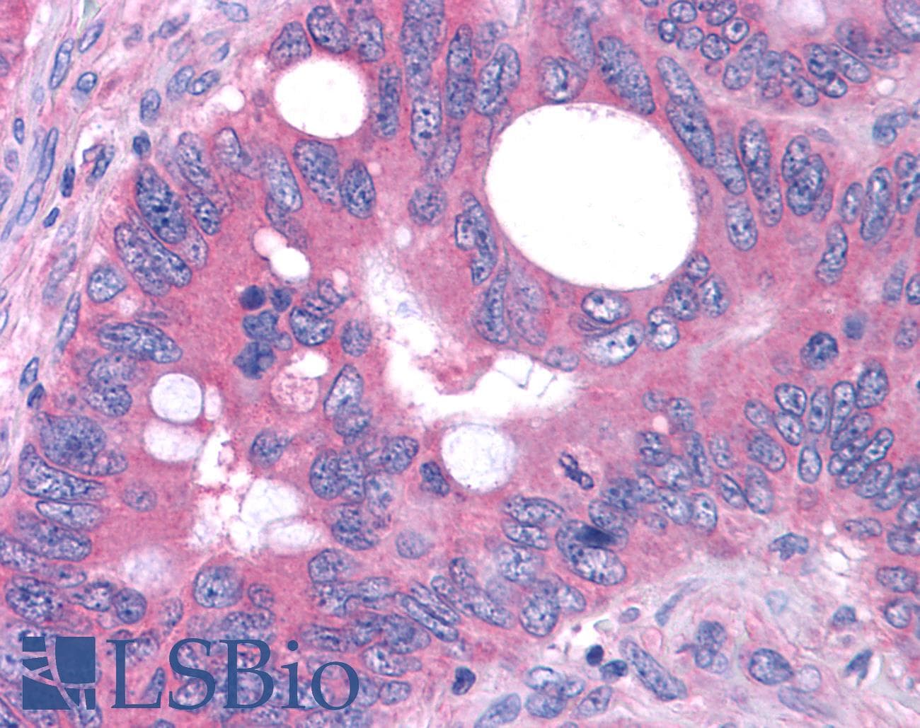 PathPlus™ GPR80 / GPR99 / OXGR1 Antibody (N-Terminus)