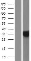 PHYHD1 Protein (Over-Expression Lysate Myc-DDK (Flag))