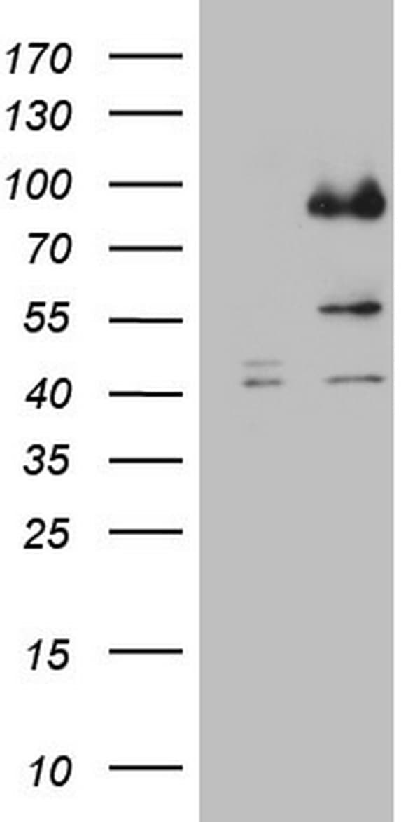 Monoclonal Mouse anti-Human CFI / Complement Factor I Antibody (clone OTI6G7, aa340-583, WB)