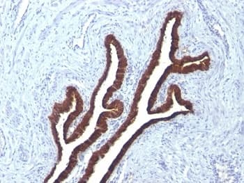 KRT7 / CK7 / Cytokeratin 7 Antibody (clone KRT7/760 + KRT7/903)