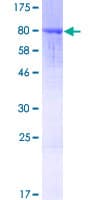 Human ANKRD44 Protein (Recombinant GST)