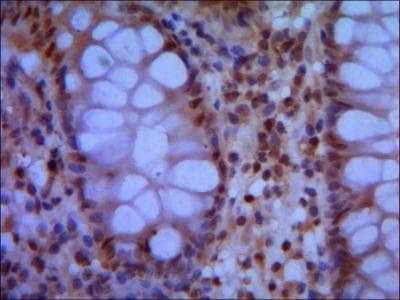 SMC1A / SMC1 Antibody