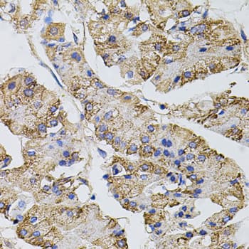 CAST / Calpastatin Antibody