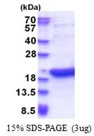 Human BATF3 Protein (Recombinant His)