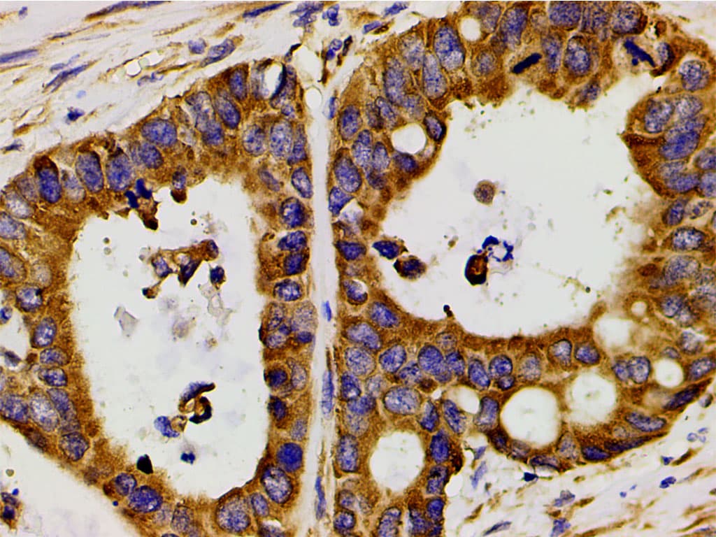 PIK3R1 / p85 Alpha Antibody (phospho-Tyr607)