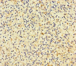 CD14 Antibody