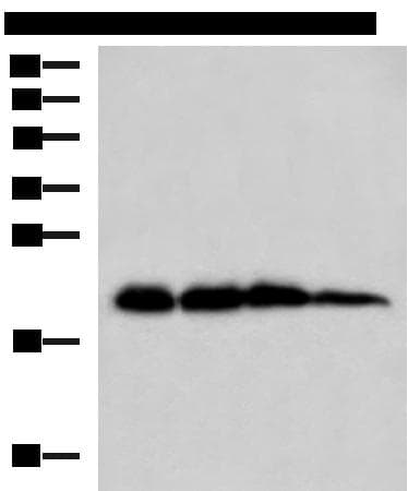 Polyclonal Rabbit anti-Human HPCAL1 / Hippocalcin-Like 1 Antibody (IHC, WB)