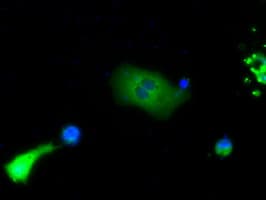 BTK Antibody (clone OTI3E9)