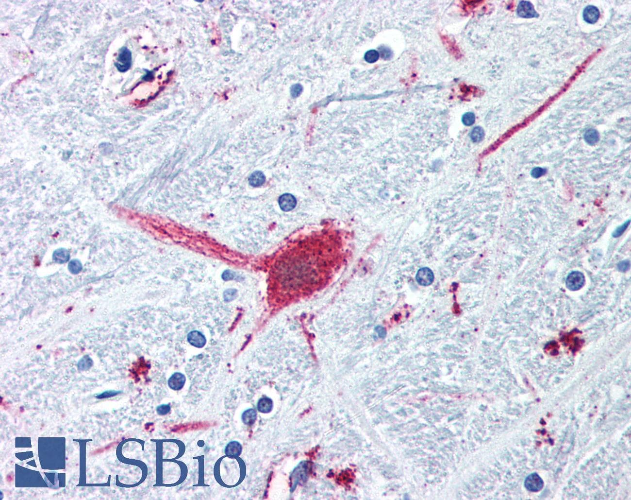 IHC-plus™ DRD3 / Dopamine Receptor D3 Antibody (Cytoplasmic Domain)