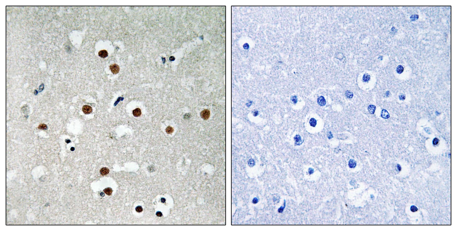 Polyclonal Rabbit anti-Human MEF2C Antibody (phospho-Ser396, IHC, WB)