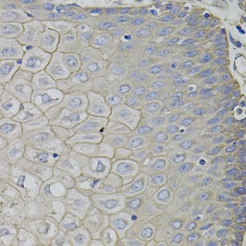 Polyclonal Rabbit anti-Human CKAP4 Antibody (AP, IHC, WB)