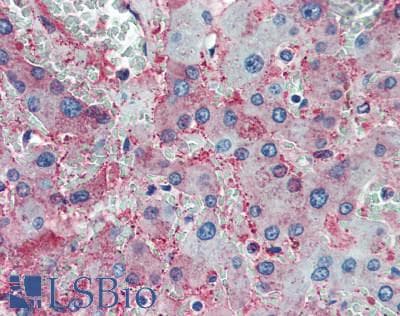 IHC-plus™ Polyclonal Rabbit anti-Human Complement C1q Antibody (IHC, WB)