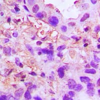 Polyclonal Rabbit anti-Human TNFAIP6 / TSG-6 Antibody (Internal, IHC, WB)