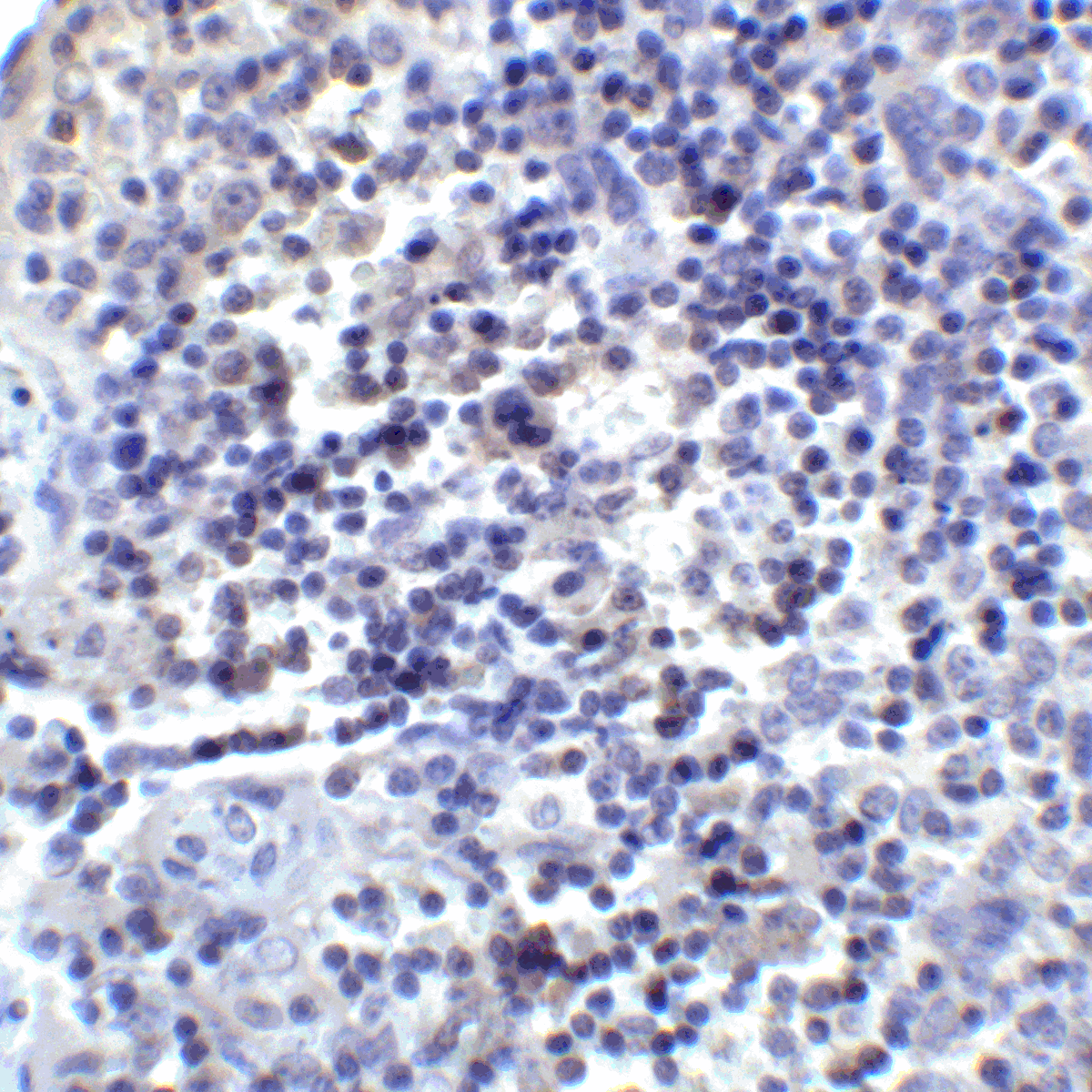 IHC-plus™ PD-L2 / PDCD1LG2 / CD273 Antibody (clone 8C12)