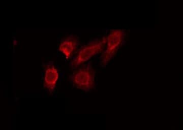 Polyclonal Rabbit anti-Human STAC2 Antibody (IF, WB)