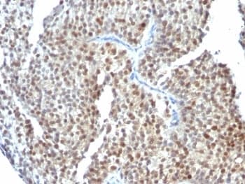 ESR2 / ER Beta Antibody (C-Terminus, clone ESR2/686, Ready-to-Use)