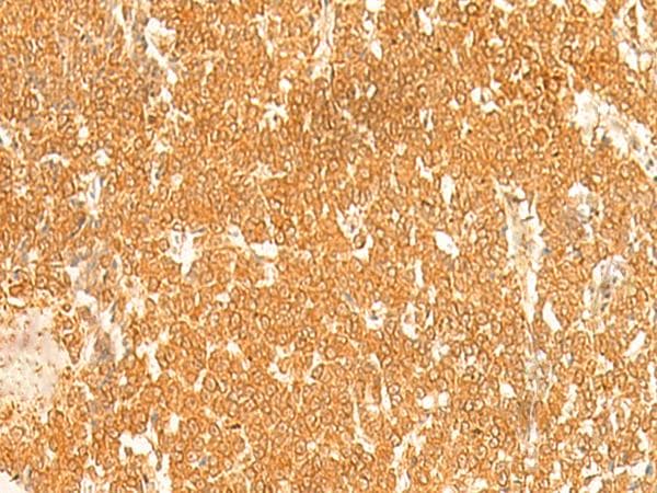 KRT76 / Keratin 76 Antibody
