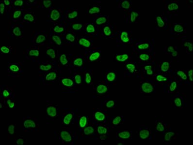 Polyclonal Rabbit anti-Human HIST1H2BN Antibody (IHC, IF)