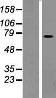 Human PLS1 / Fimbrin Protein (Over-Expression Lysate Myc-DDK (Flag))